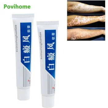1Pcs Vitiligotreament Antibakterinis Kremas Psoriazė Lokalizuota Vitiligo Tepalas Balta Dėmė Mycosis Leukoplakia Gydymas
