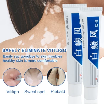 1Pcs Vitiligotreament Antibakterinis Kremas Psoriazė Lokalizuota Vitiligo Tepalas Balta Dėmė Mycosis Leukoplakia Gydymas