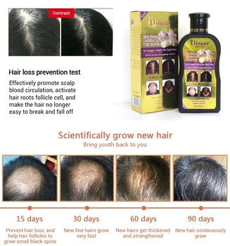 Imbieras plaukų augimą, šampūnas, plaukų slinkimo anti-pleiskanų elastinga šampūnas spartaus augimo plaukų eterinis aliejus 200ml
