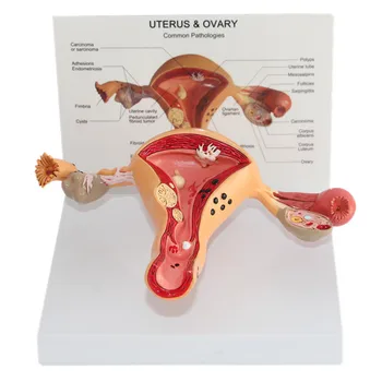 1:1 Patologinių Gimdos ir Kiaušidžių Anatomijos Modelis Traumos Anatomija Skeletas Dantų Anatomijos Šešėlis Medicinos Mokymo Manikins